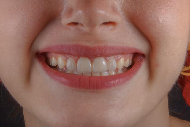 odontoiatria pediatrica